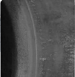 04-unilateral desgaste anormal